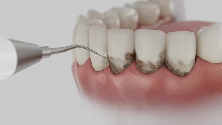Reliable Emergency Dentist contractor in Beloit, WI by Smile Center Dentistry